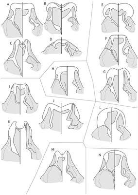 Coevolutionary analysis of the Philopteroides Mey, 2004 (Phthiraptera: Ischnocera) parasitizing bulbuls (Passeriformes: Pycnonotidae)